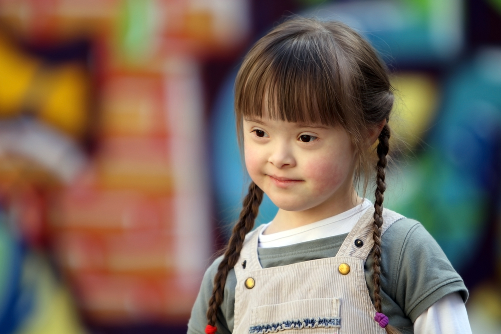 cute-little-girl-down-syndrome